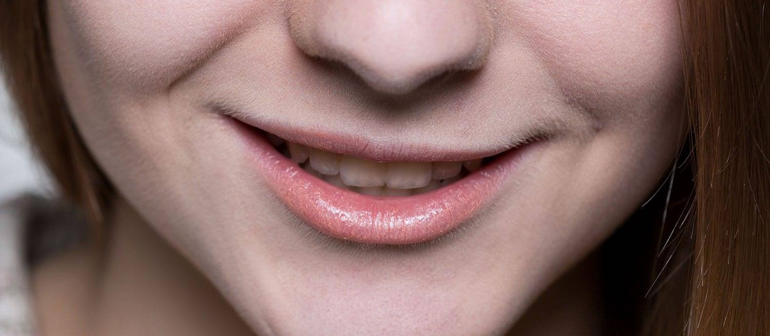 Smile Banner - Dentist in Bendigo