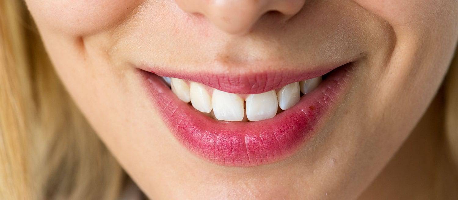 Smile Banner - Dentist in Bendigo