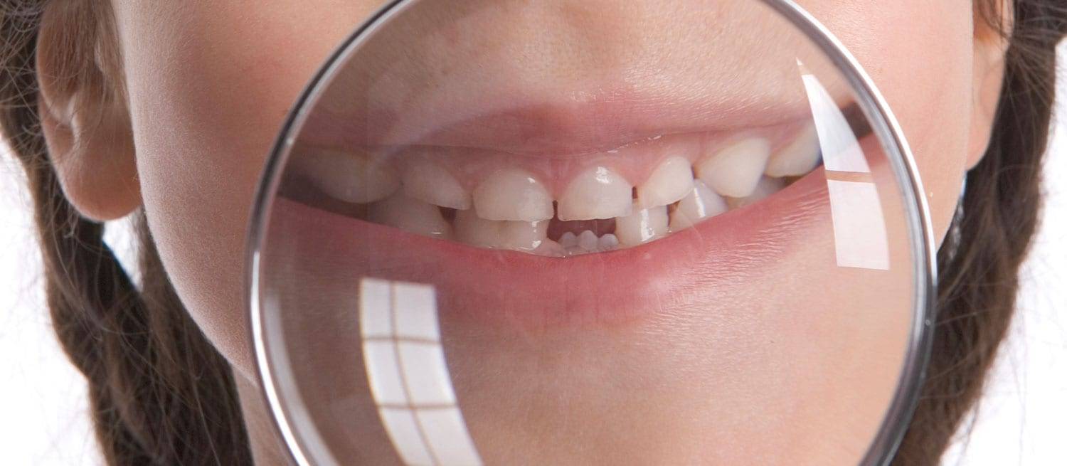 Smile Banner - Dentist in Bendigo